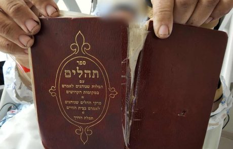 ספר התהילים שהציל את חיי הפצוע הקשה בפיגוע בירושלים